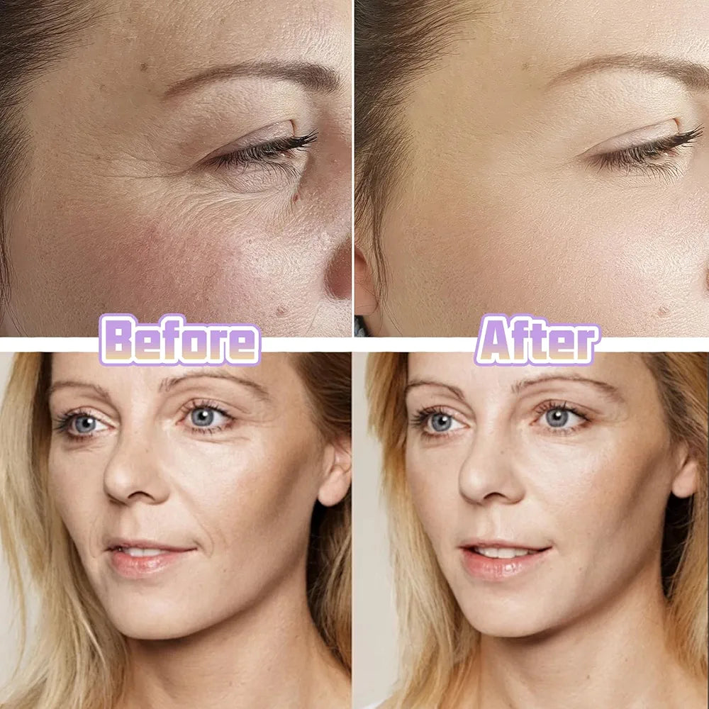Instant Lifting Tapes For Tired Faces  ( 40 pieces )